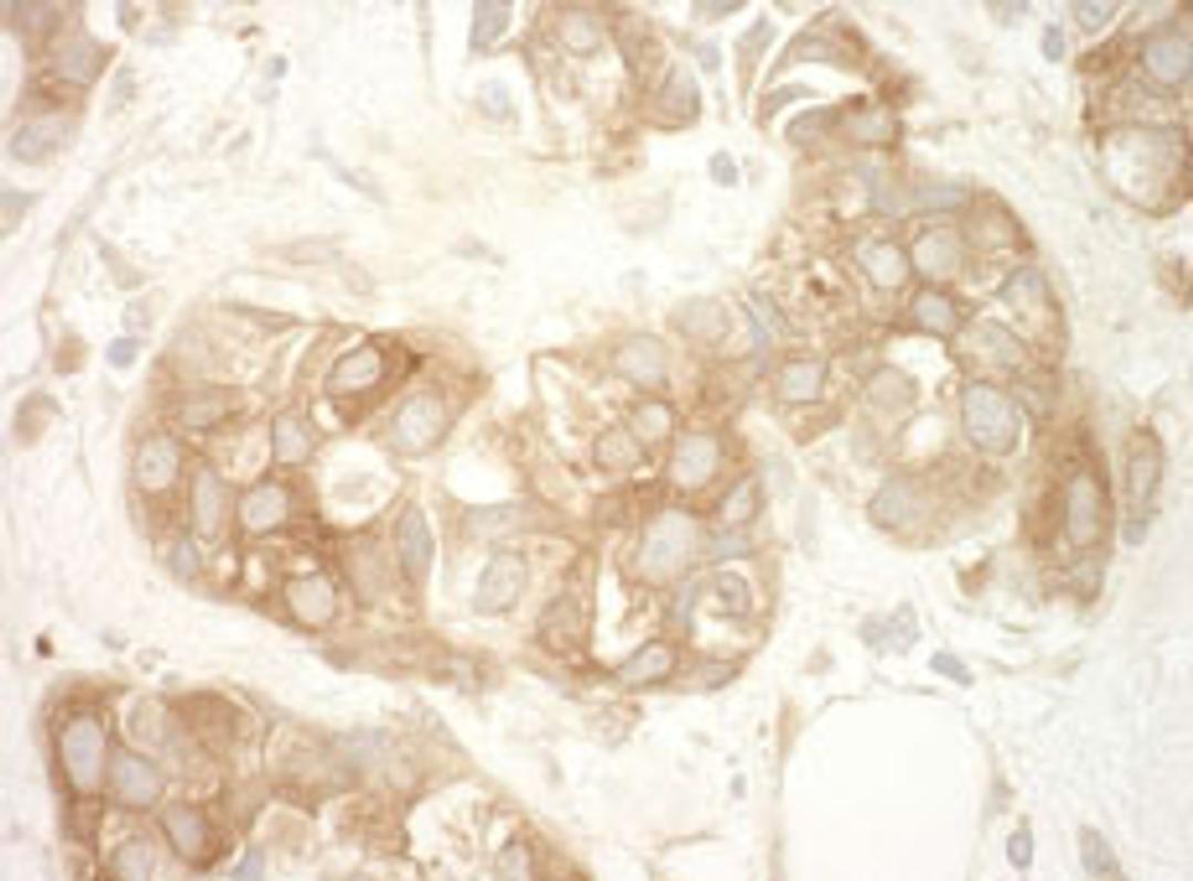 Detection of human Vinculin by immunohistochemistry.