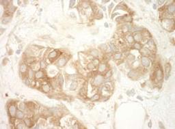 Detection of human Vinculin by immunohistochemistry.