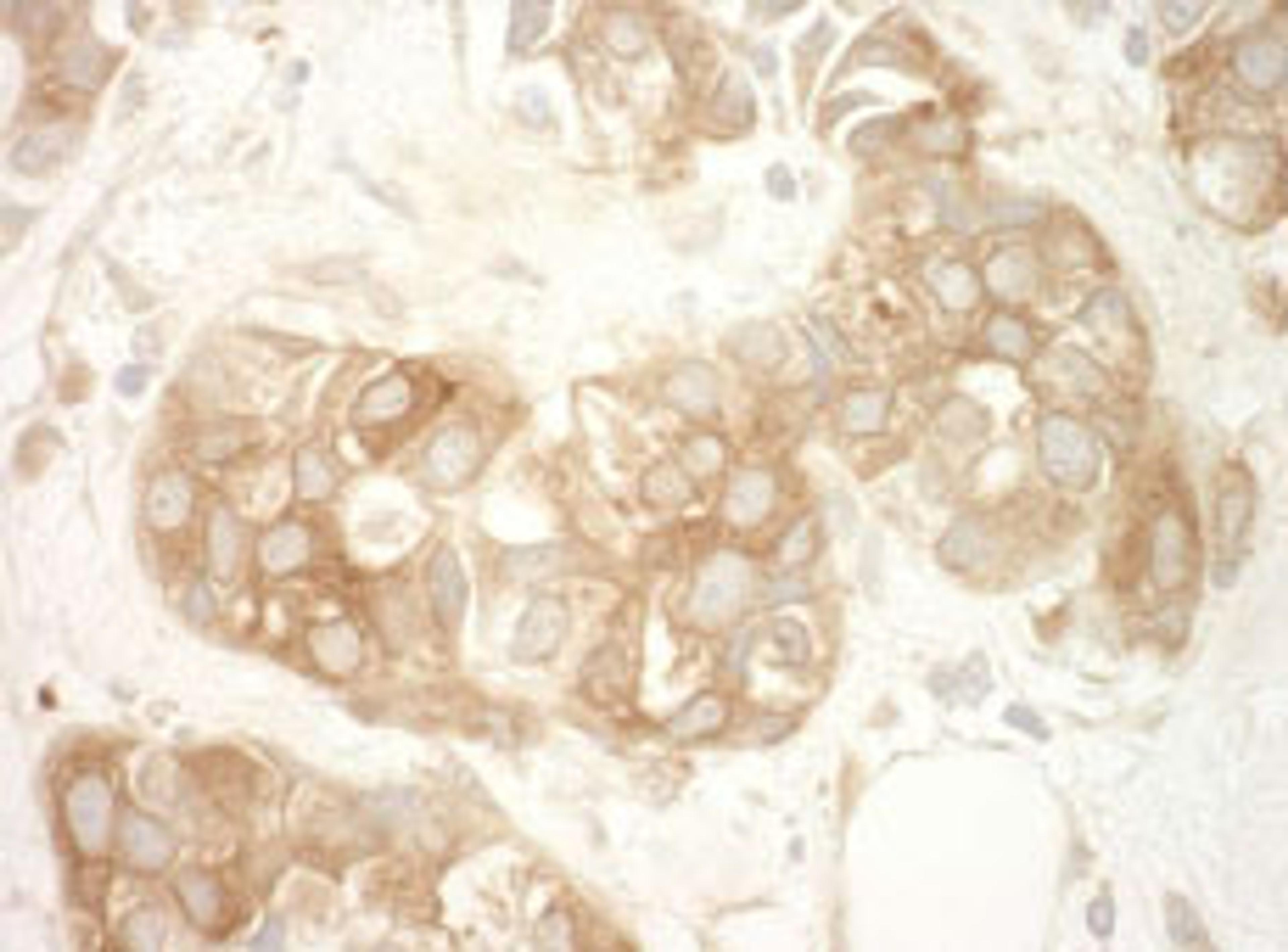 Detection of human Vinculin by immunohistochemistry.