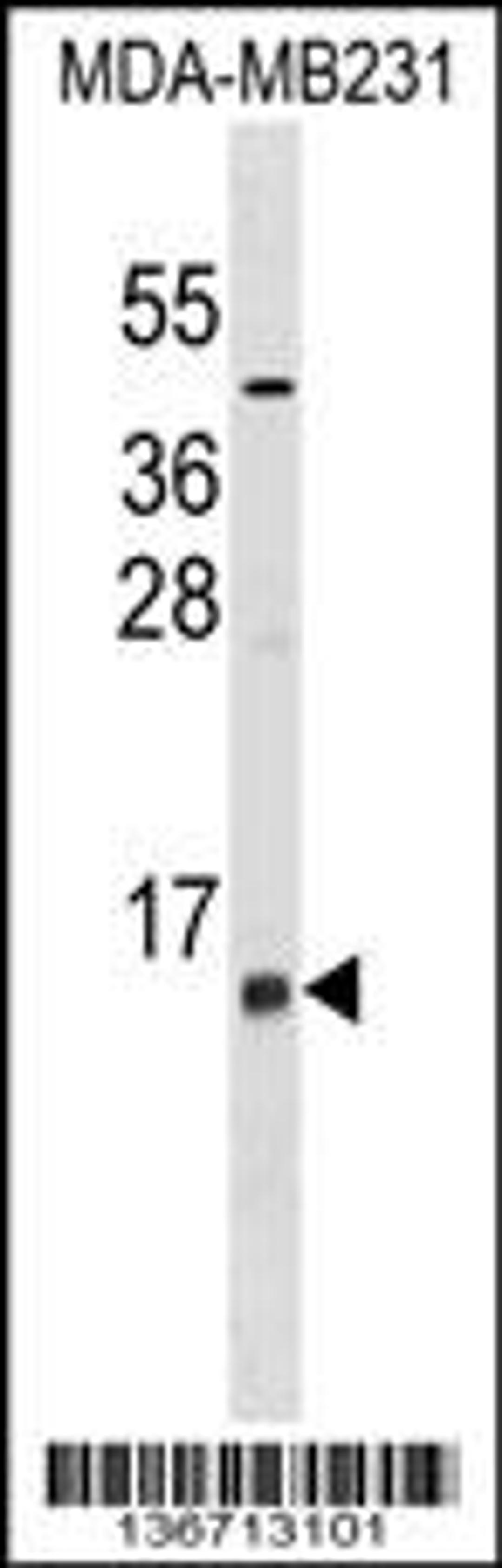 Western blot analysis in MDA-MB231 cell line lysates (35ug/lane).