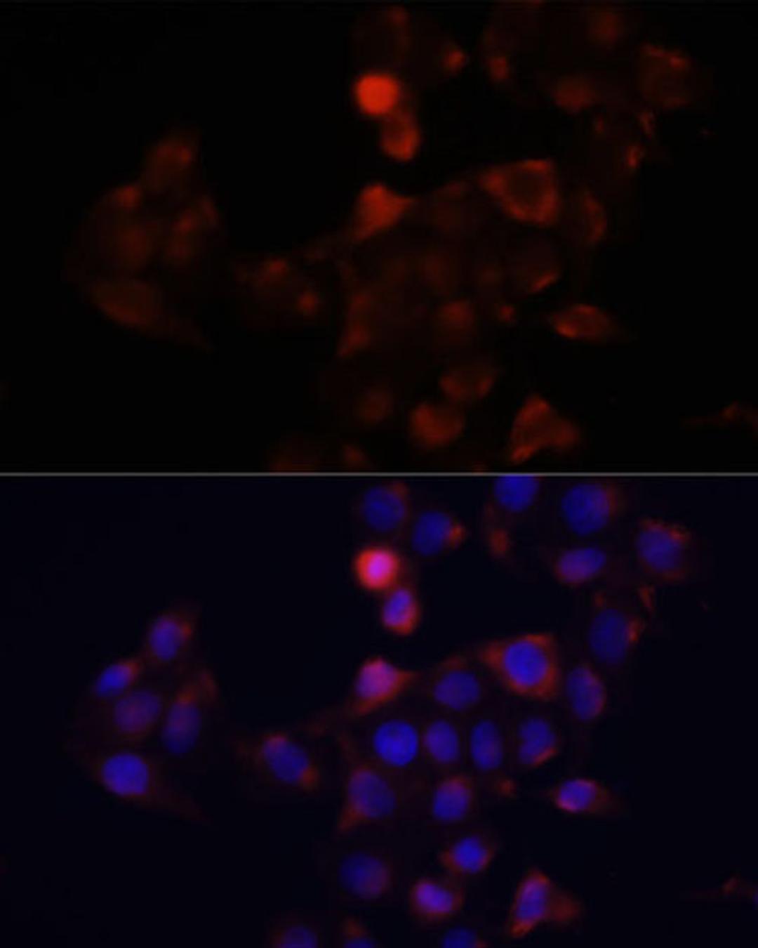 Immunofluorescence - DCX antibody (A14611)