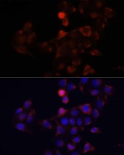 Immunofluorescence - DCX antibody (A14611)