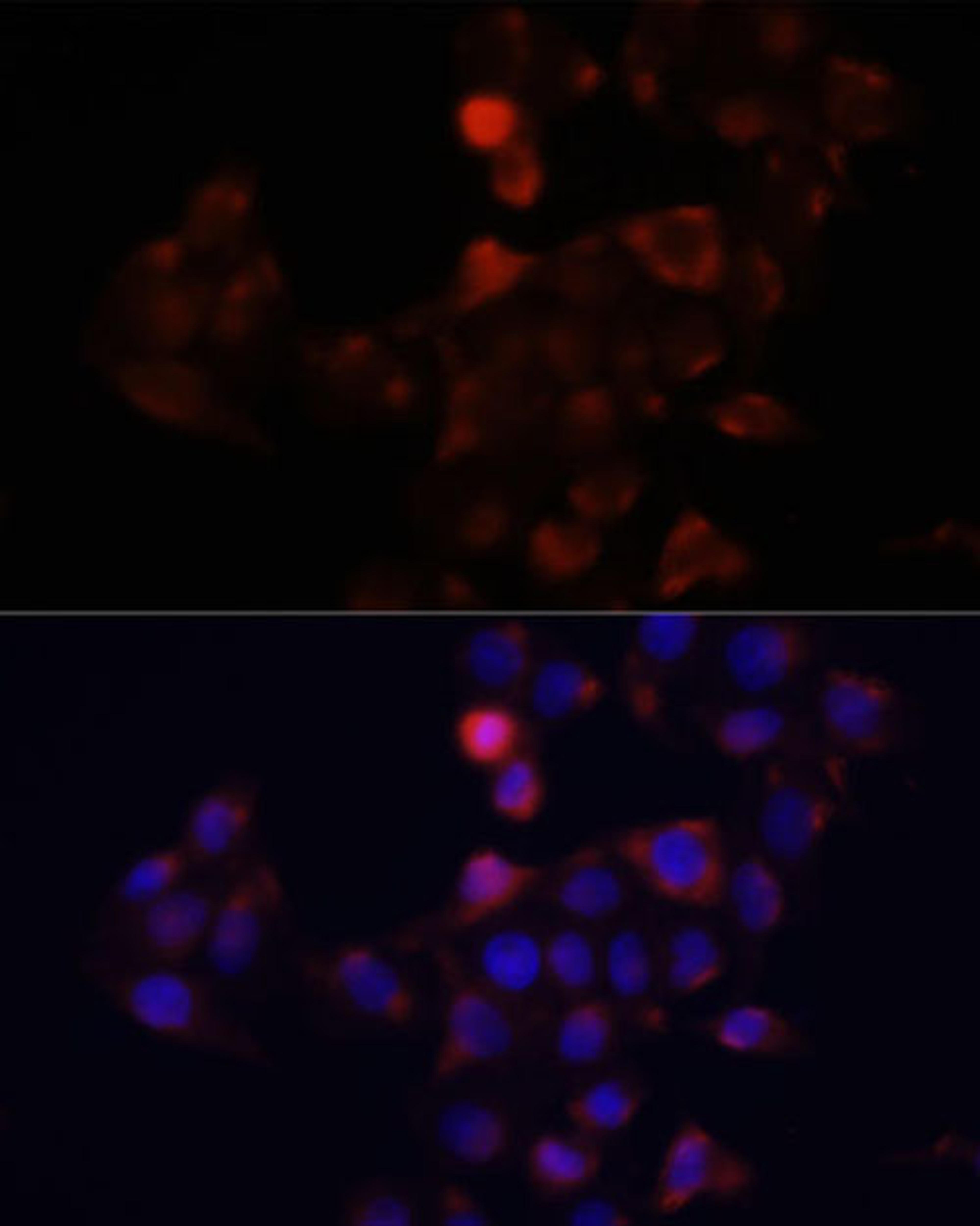 Immunofluorescence - DCX antibody (A14611)