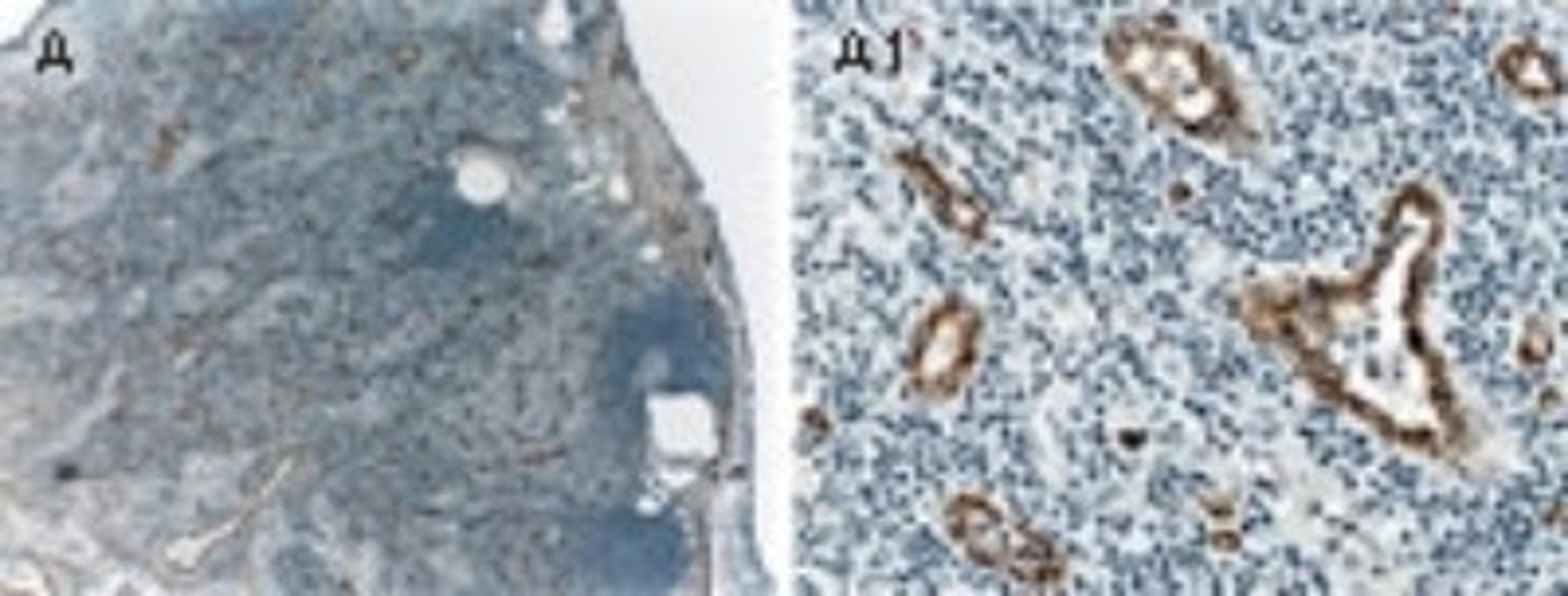 Immunohistochemistry-Paraffin: ASK1 Antibody [NB100-56077] - Formalin-fixed paraffin-embedded tissue section of human reactive tonsil stained for ASK1 expression using NB100-56077 at 1:2000.  A and A1. Low and high magnification, respectively.  ASK1 expression was seen in the vasculature (endothelial cells). Hematoxylin-eosin counterstain.