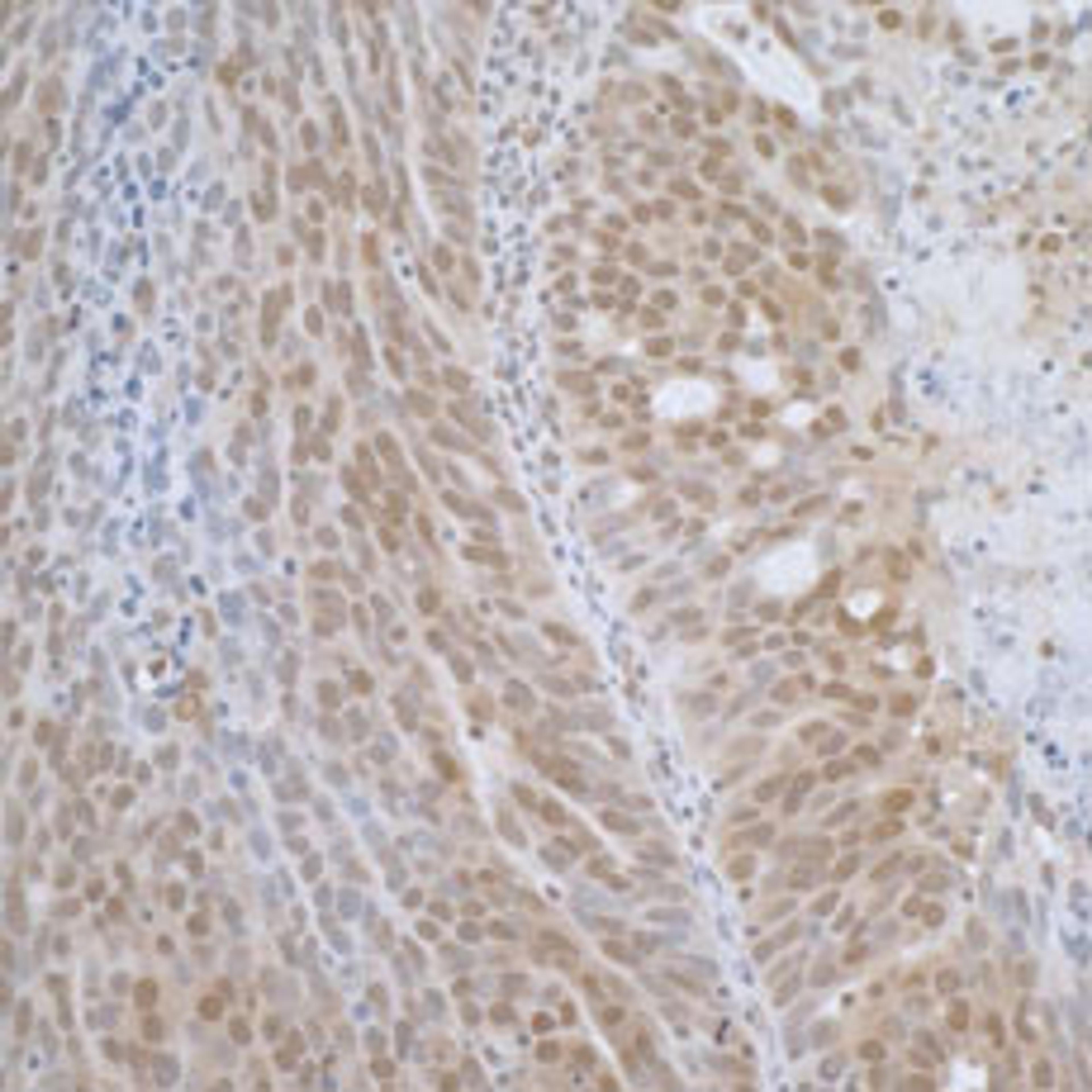 Detection of human TCEB1 by immunohistochemistry.