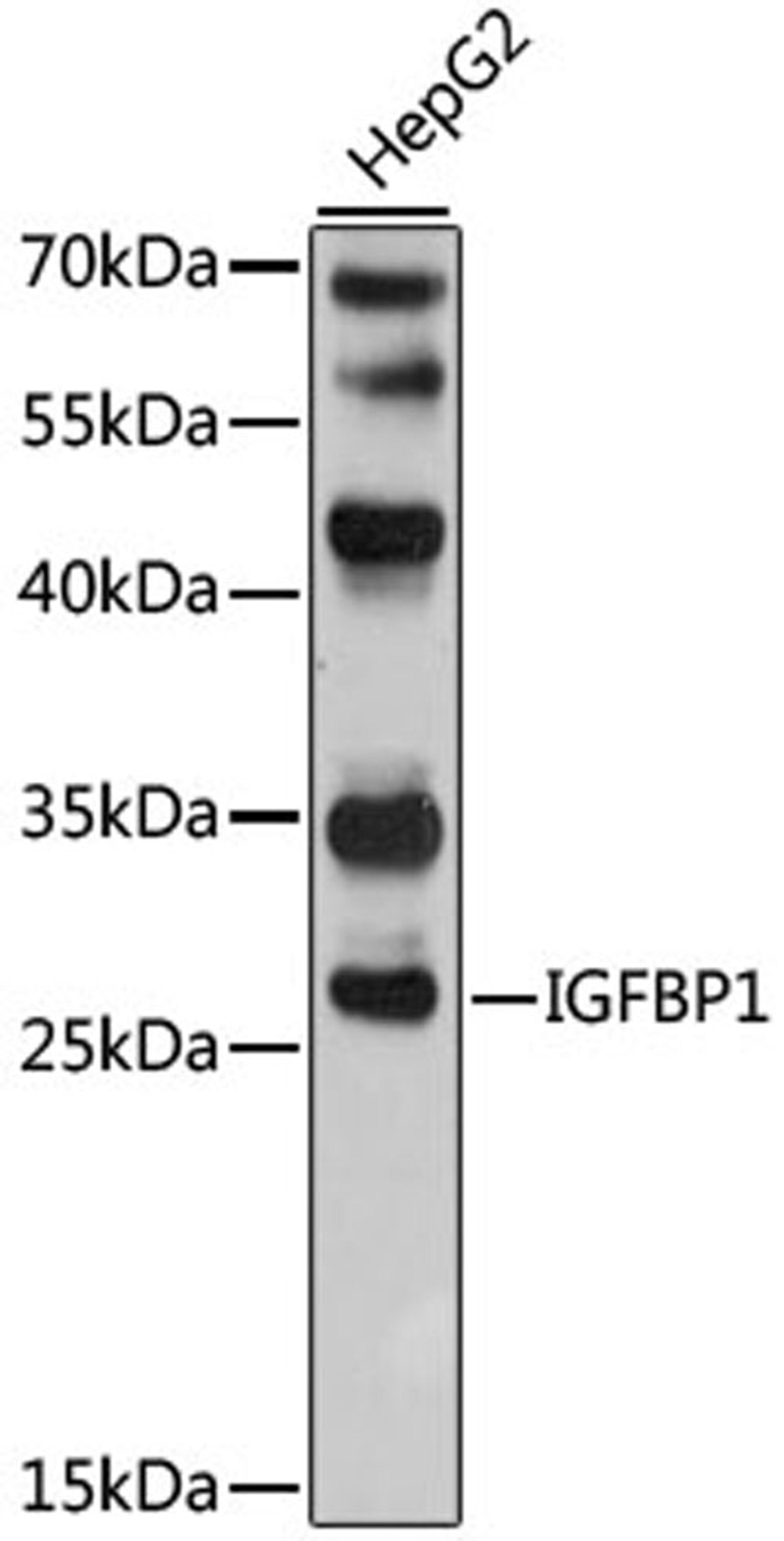 Western blot - IGFBP1 antibody (A2981)