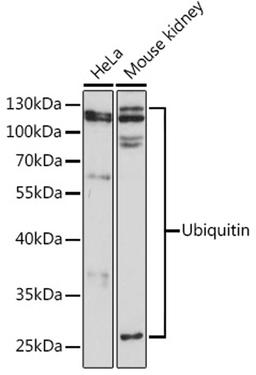 Western blot - Ubiquitin pAb (A0162)