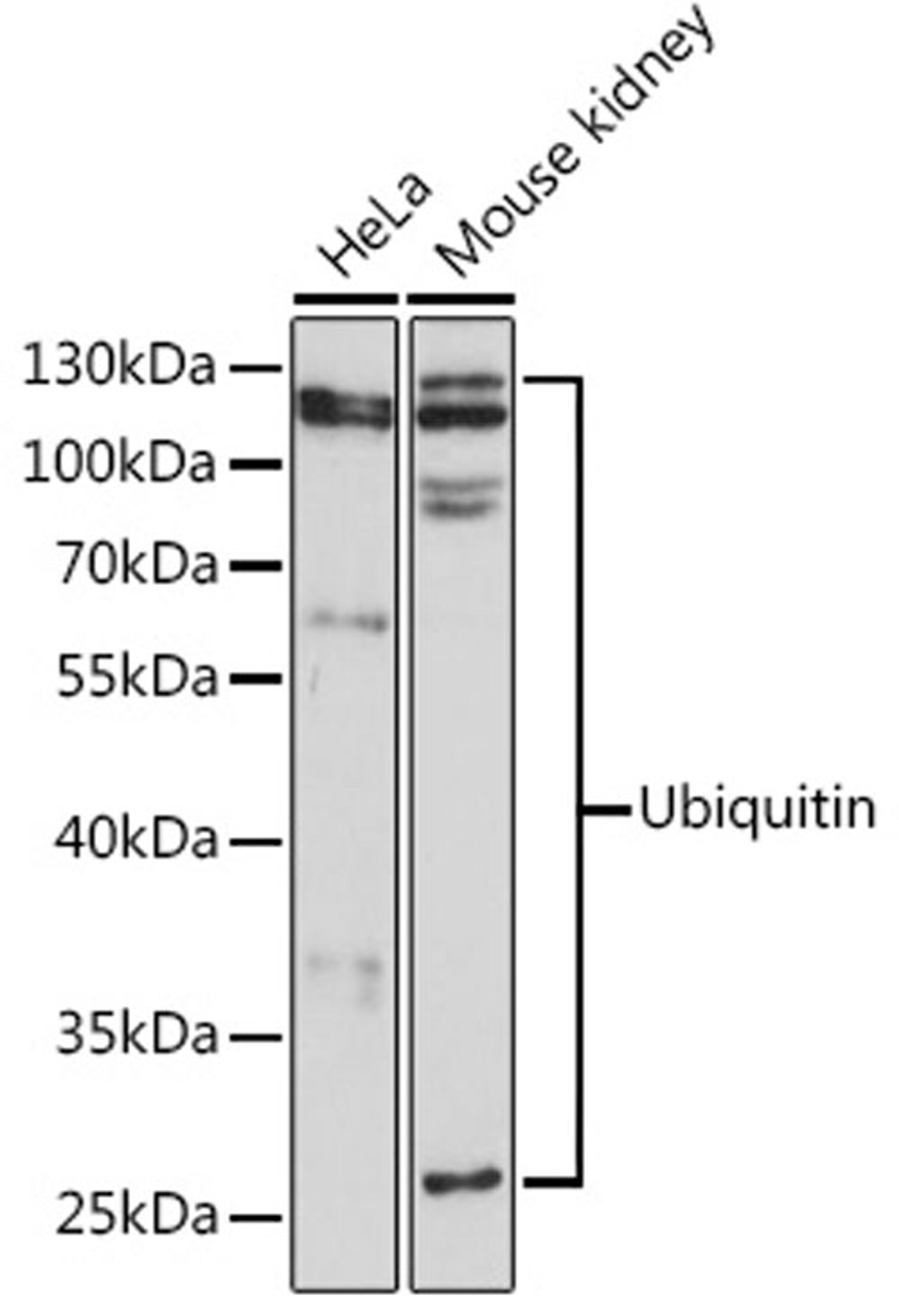 Western blot - Ubiquitin pAb (A0162)