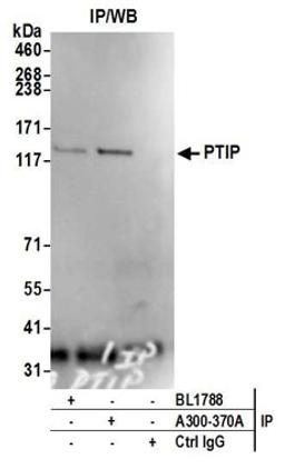 Detection of human PTIP by western blot of immunoprecipitates.