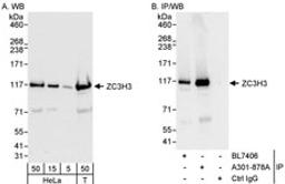 Detection of human ZC3H3 by western blot and immunoprecipitation.