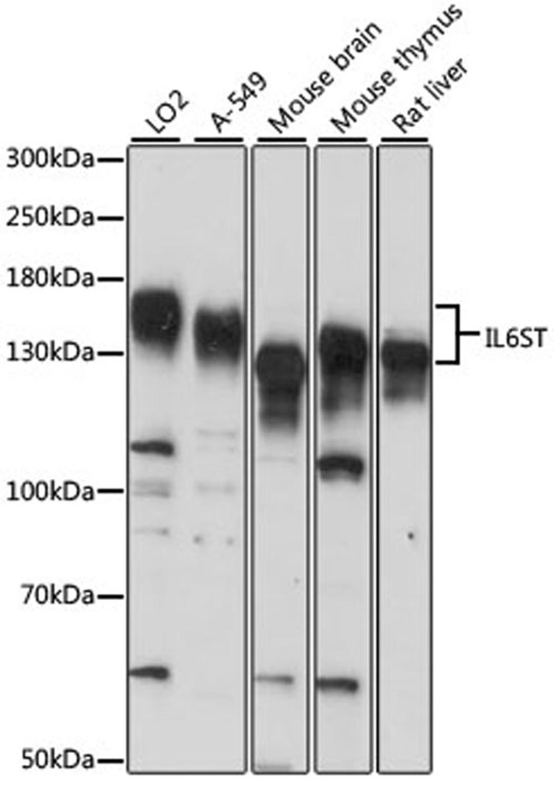 Western blot - IL6ST antibody (A14656)