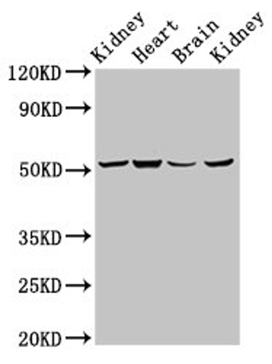 Western Blot. Positive WB detected in: Rat kidney tissue, Mouse heart tissue, Mouse brain tissue, Mouse kidney tissue. All lanes: NDUFS2 antibody at 6.9ug/ml. Secondary. Goat polyclonal to rabbit IgG at 1/50000 dilution. Predicted band size: 53, 52 kDa. Observed band size: 53 kDa. 