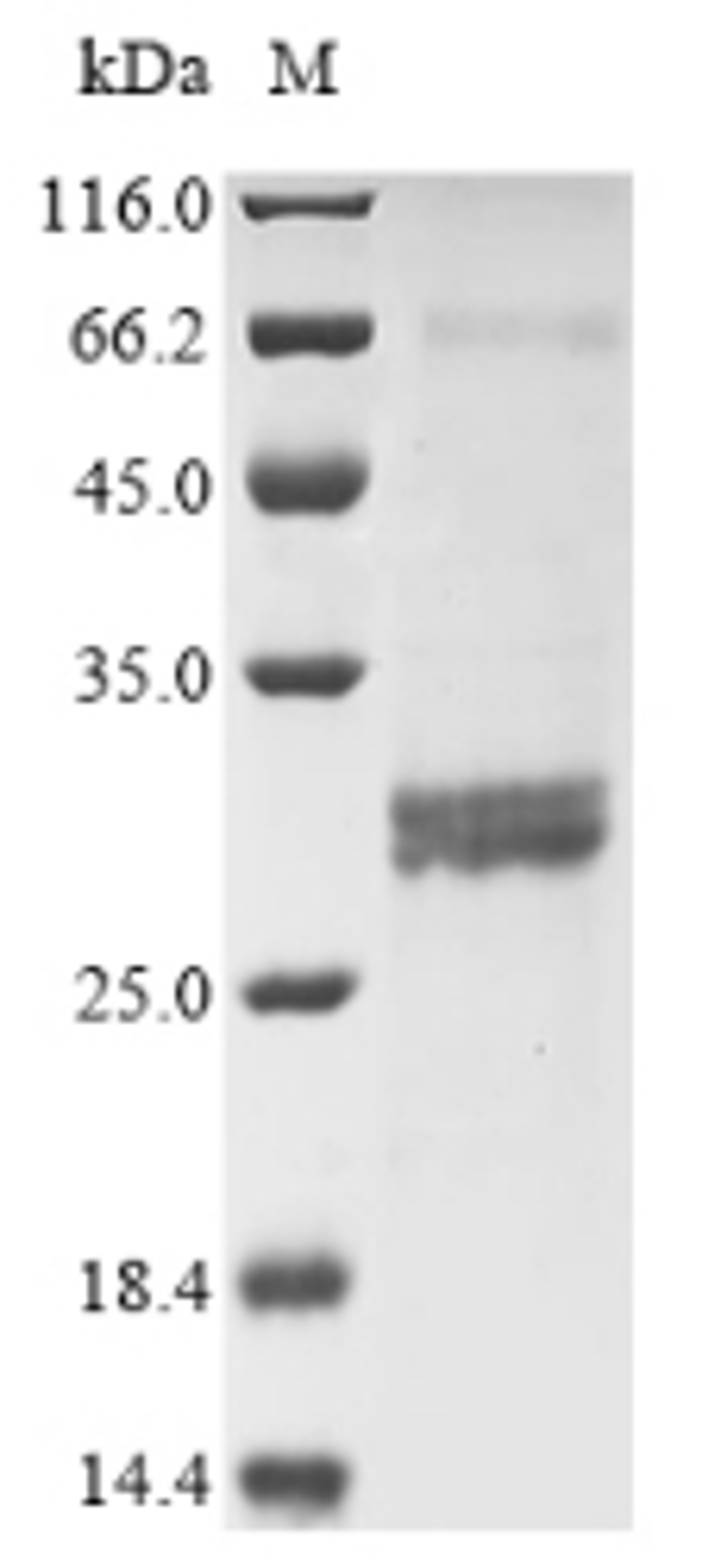(Tris-Glycine gel) Discontinuous SDS-PAGE (reduced) with 5% enrichment gel and 15% separation gel.