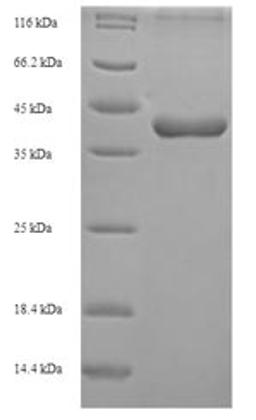 (Tris-Glycine gel) Discontinuous SDS-PAGE (reduced) with 5% enrichment gel and 15% separation gel.