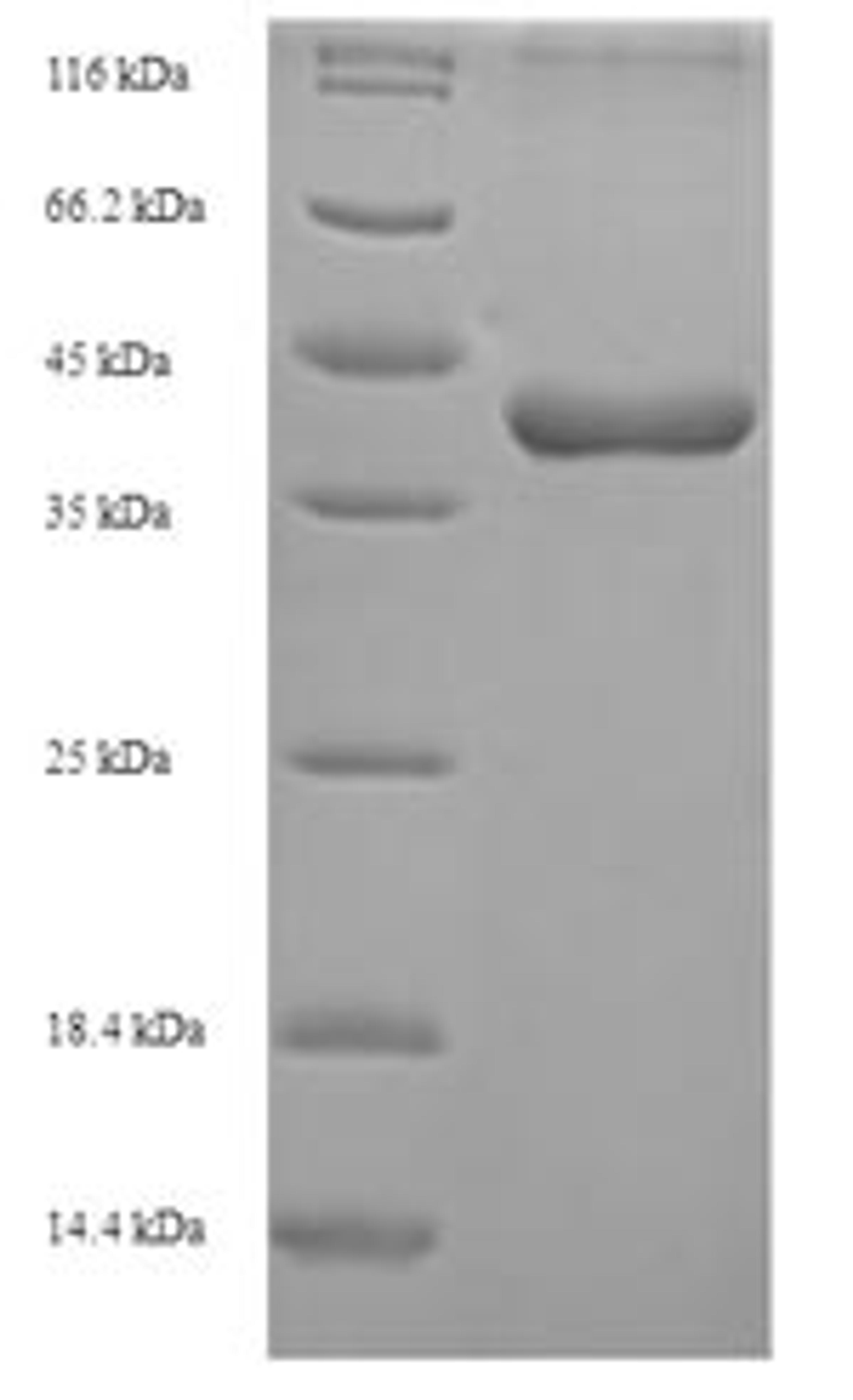 (Tris-Glycine gel) Discontinuous SDS-PAGE (reduced) with 5% enrichment gel and 15% separation gel.