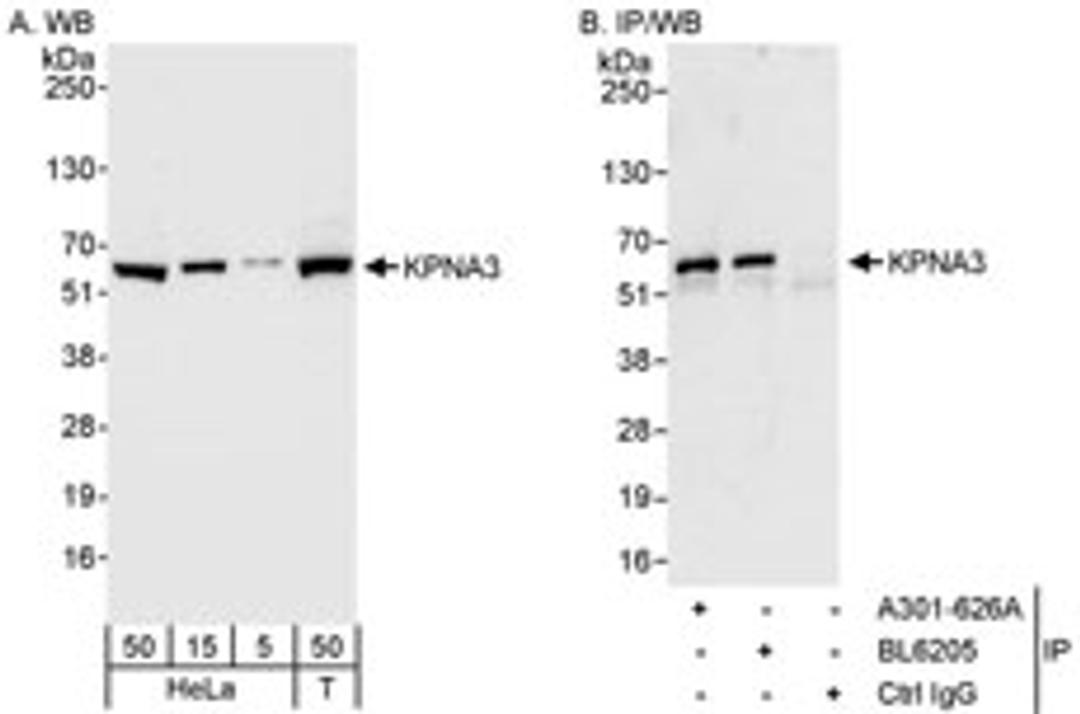 Detection of human KPNA3 by western blot and immunoprecipitation.