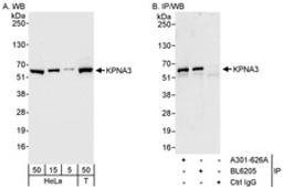 Detection of human KPNA3 by western blot and immunoprecipitation.