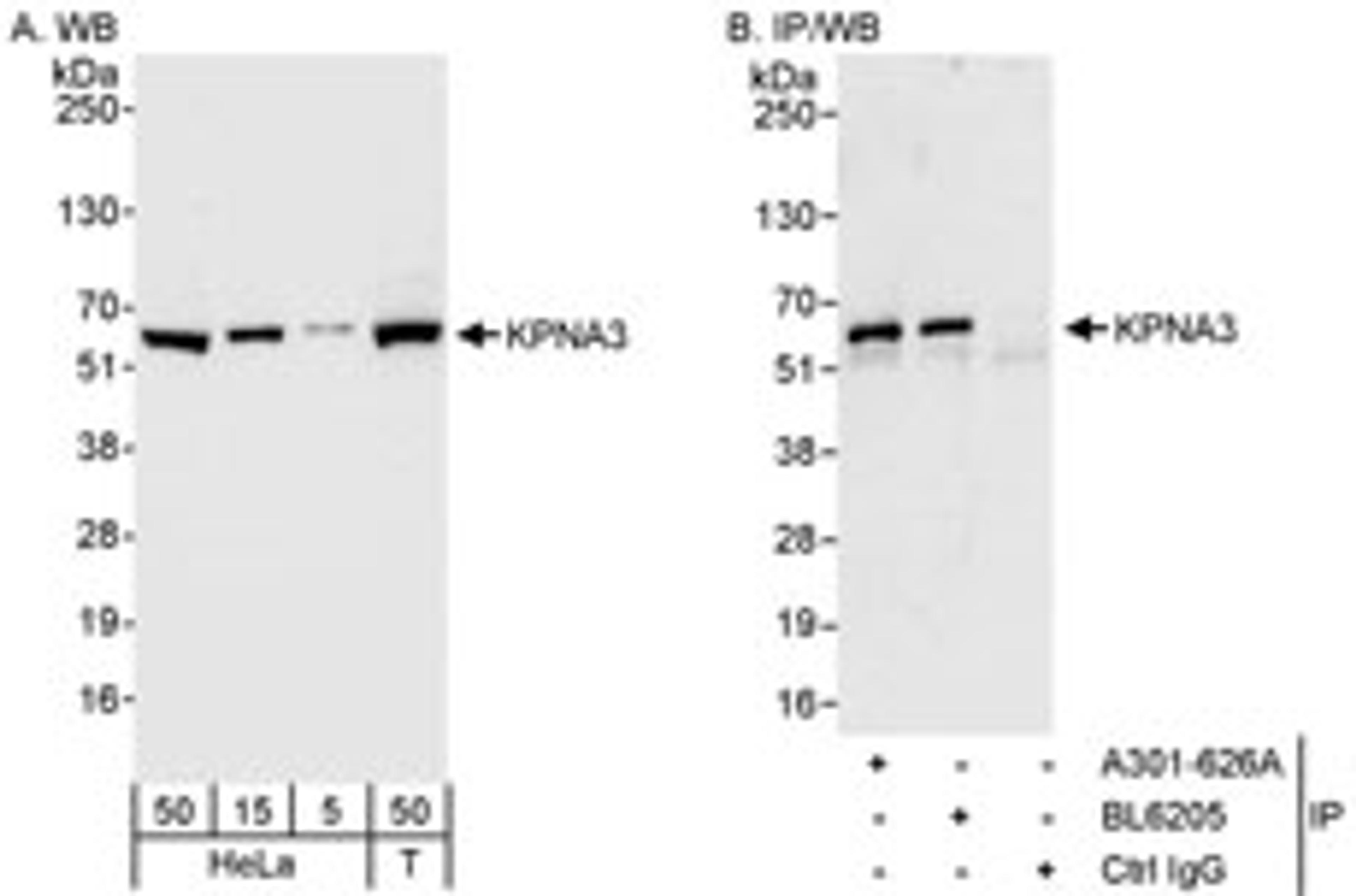 Detection of human KPNA3 by western blot and immunoprecipitation.