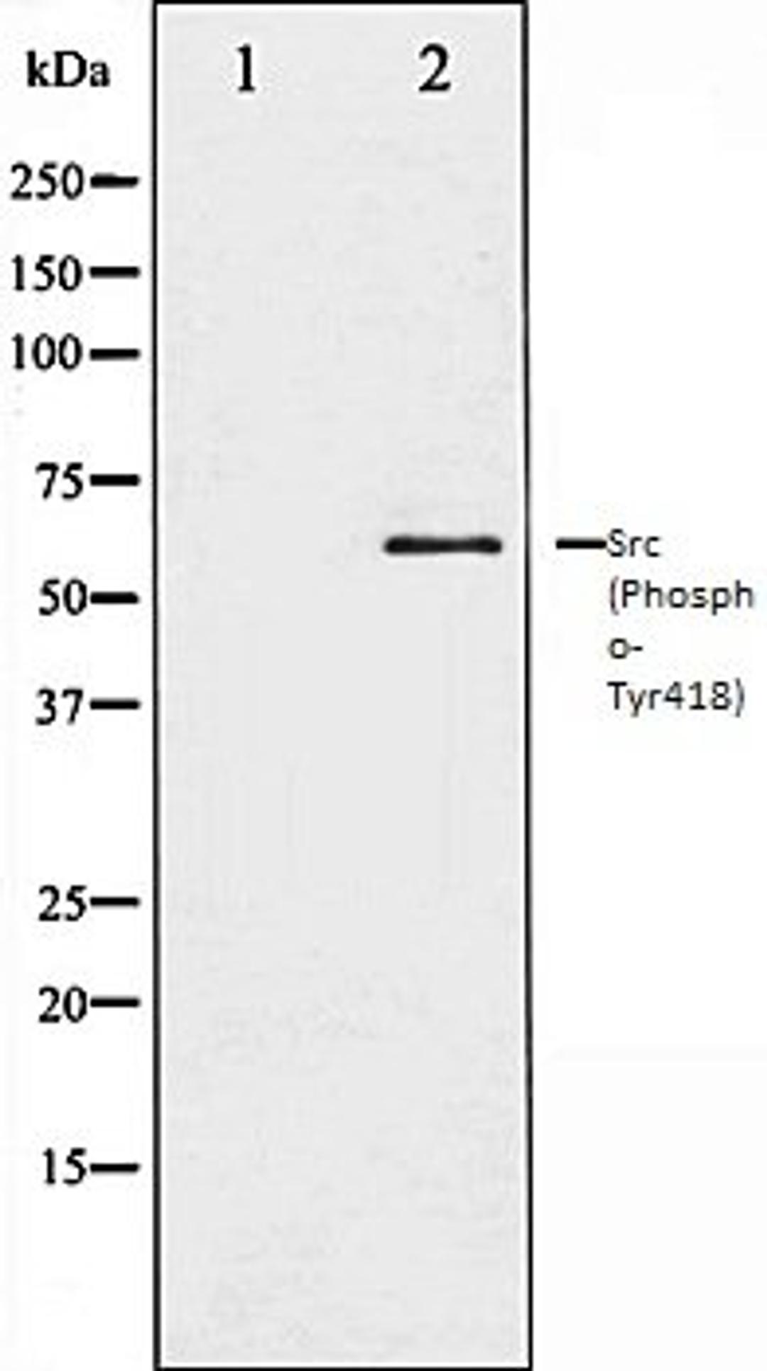 Western blot analysis of COLO205 whole cell lysates using Src (Phospho-Tyr418) antibody, The lane on the left is treated with the antigen-specific peptide.