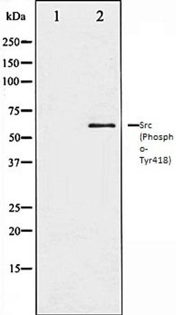 Western blot analysis of COLO205 whole cell lysates using Src (Phospho-Tyr418) antibody, The lane on the left is treated with the antigen-specific peptide.