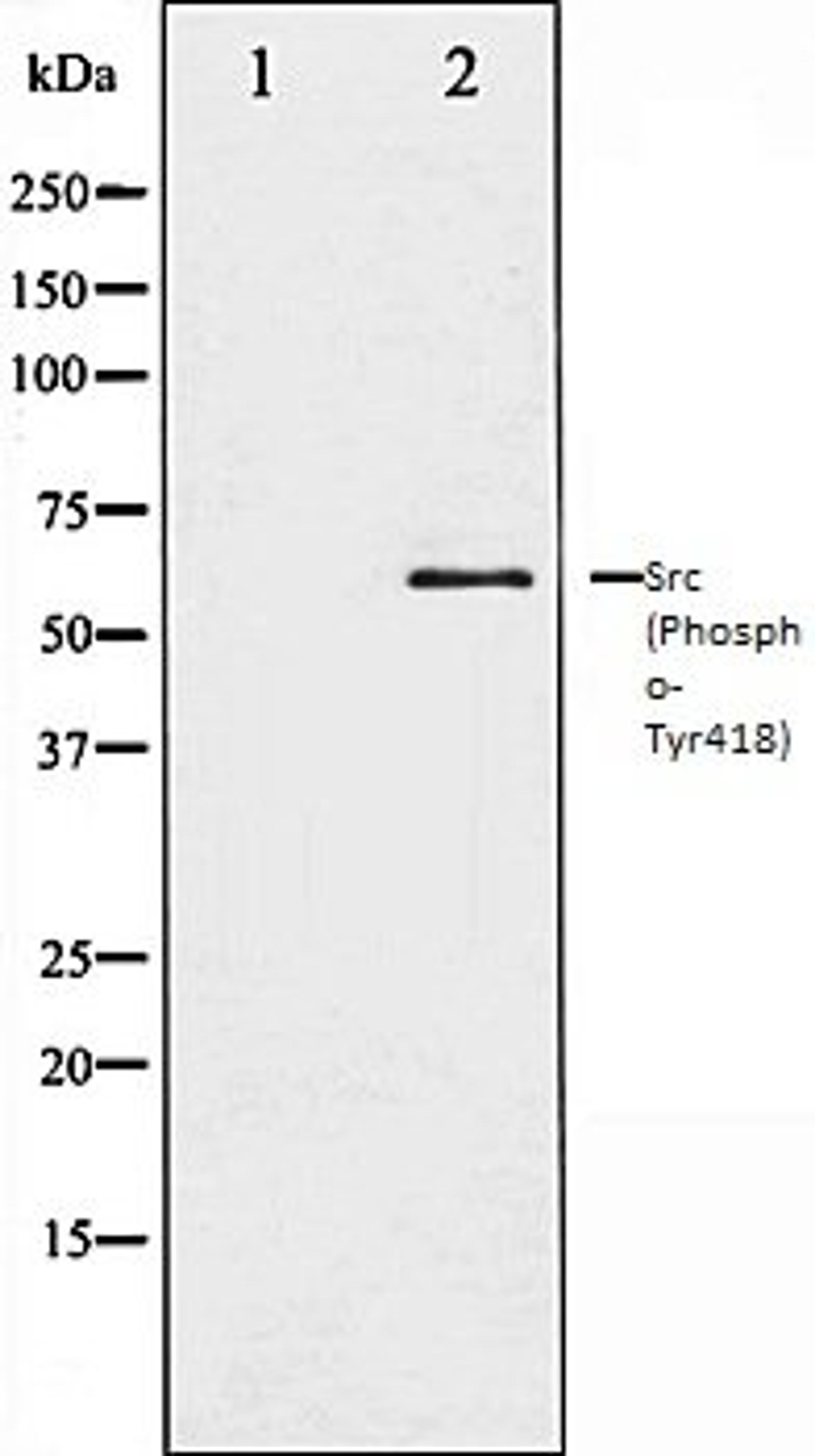 Western blot analysis of COLO205 whole cell lysates using Src (Phospho-Tyr418) antibody, The lane on the left is treated with the antigen-specific peptide.