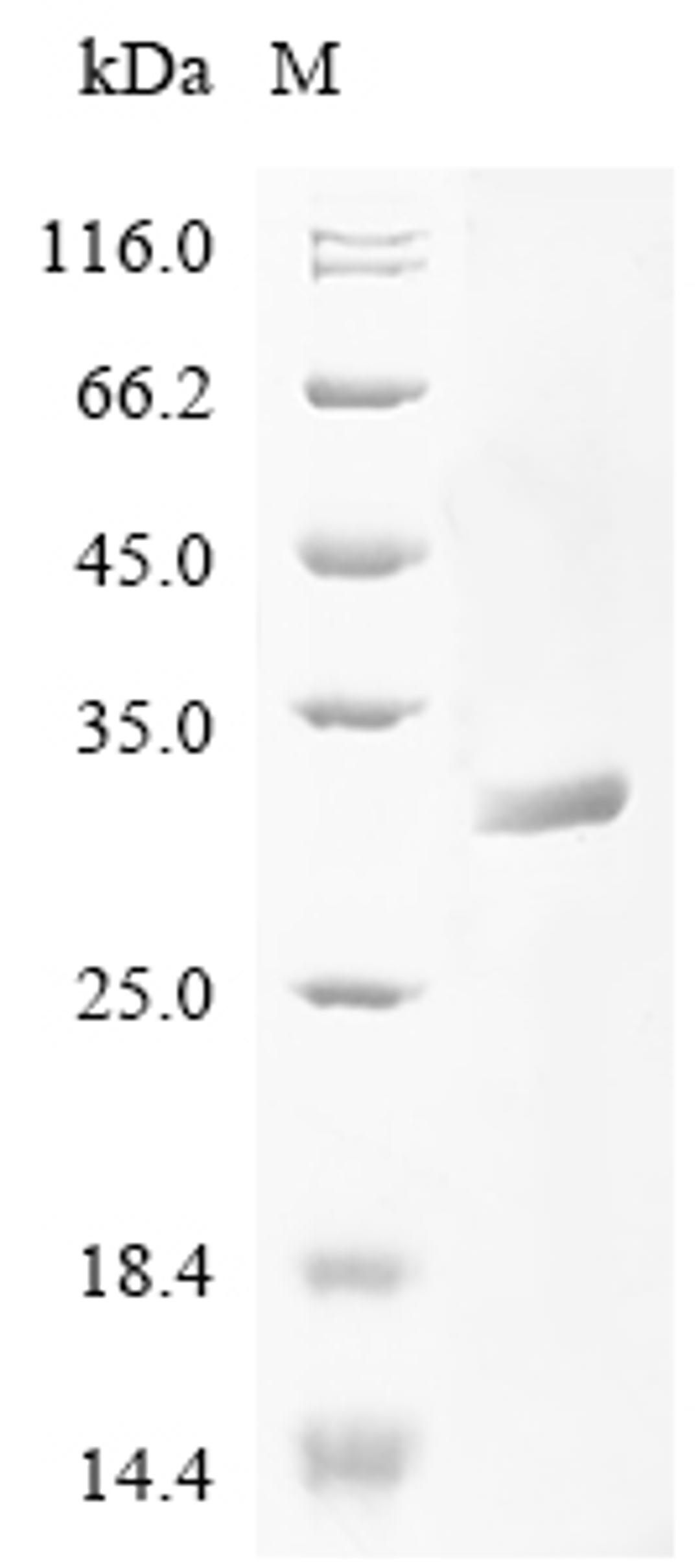 (Tris-Glycine gel) Discontinuous SDS-PAGE (reduced) with 5% enrichment gel and 15% separation gel.