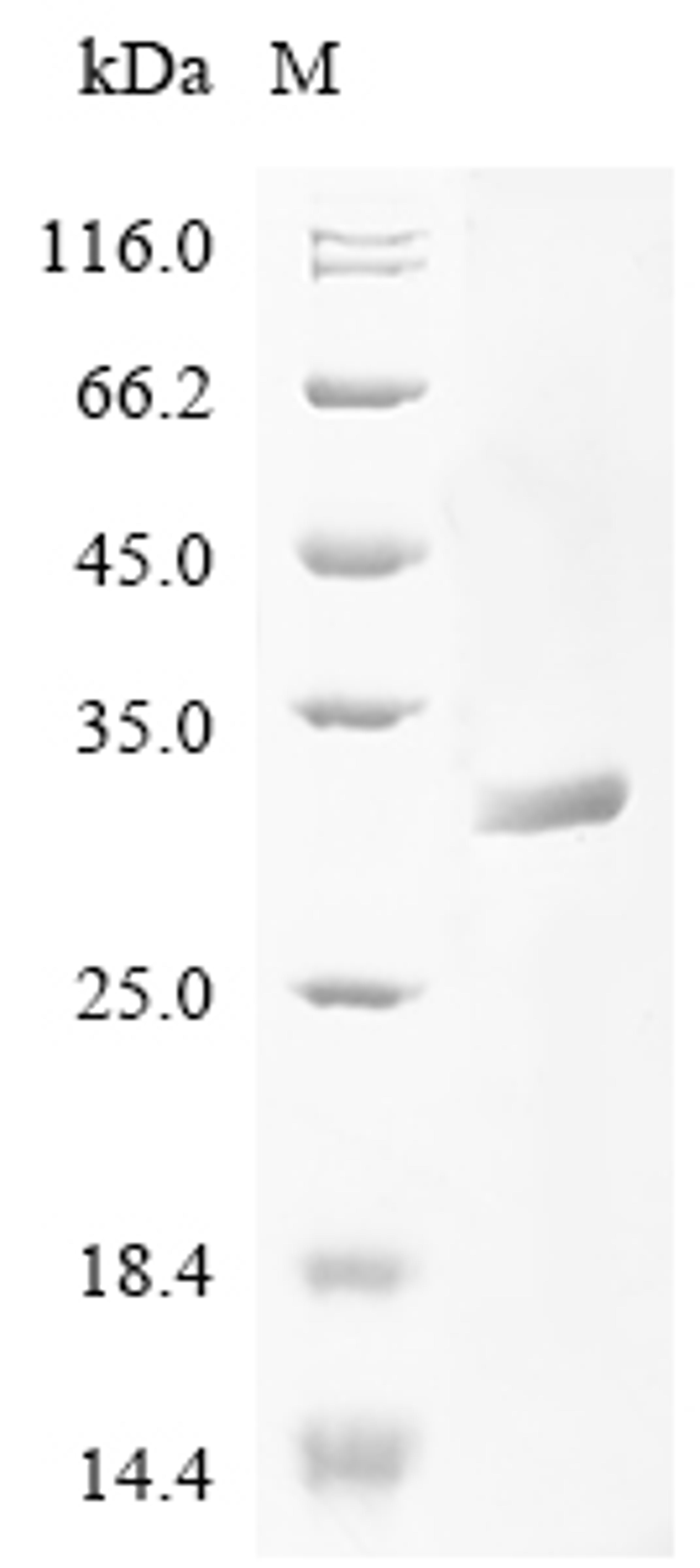 (Tris-Glycine gel) Discontinuous SDS-PAGE (reduced) with 5% enrichment gel and 15% separation gel.
