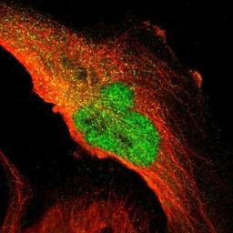 Immunocytochemistry/Immunofluorescence: UBE1 Antibody [NBP1-90307] - Staining of human cell line U-251 MG shows positivity in nucleus & cytoplasm.