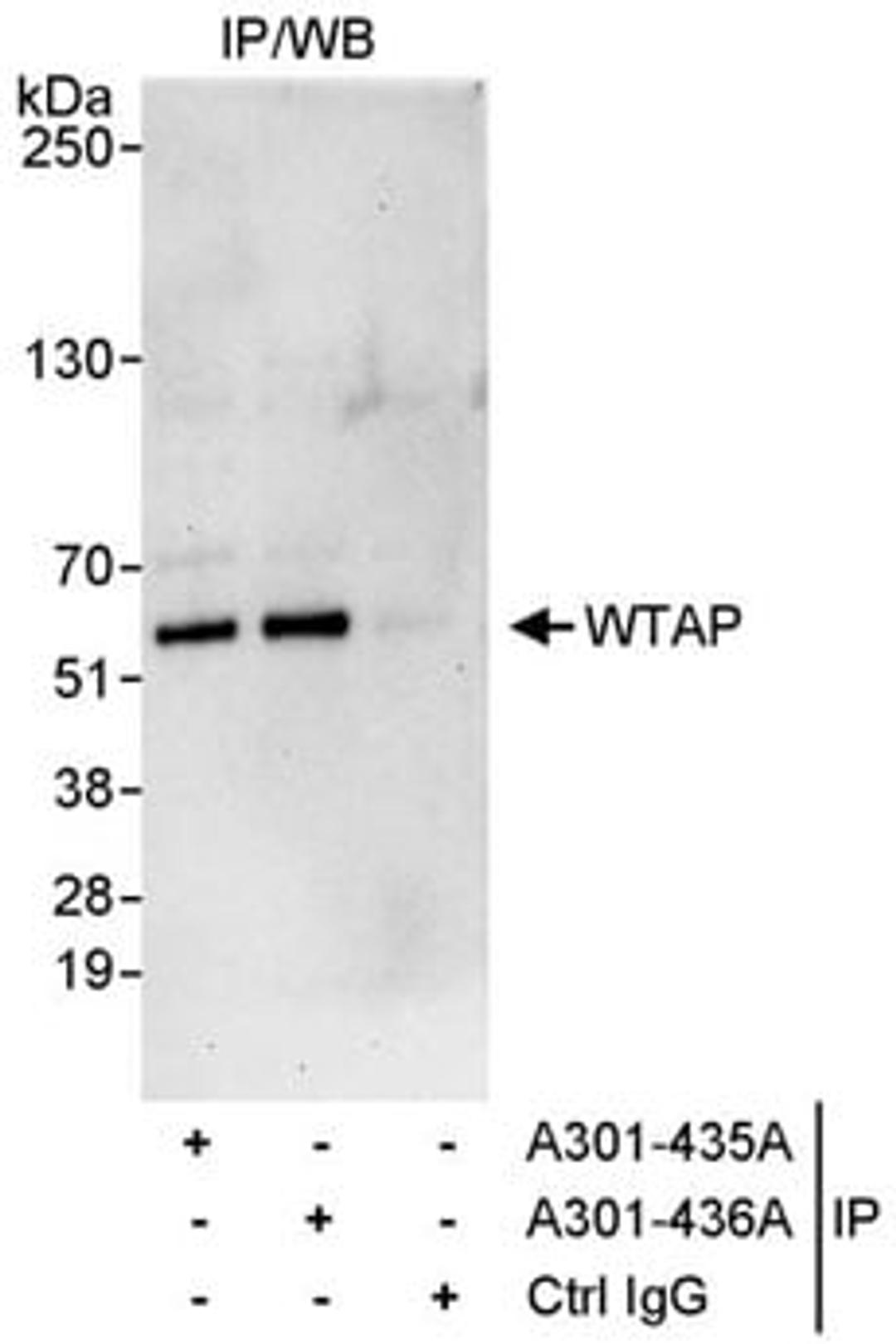 Detection of human WTAP by western blot of immunoprecipitates.