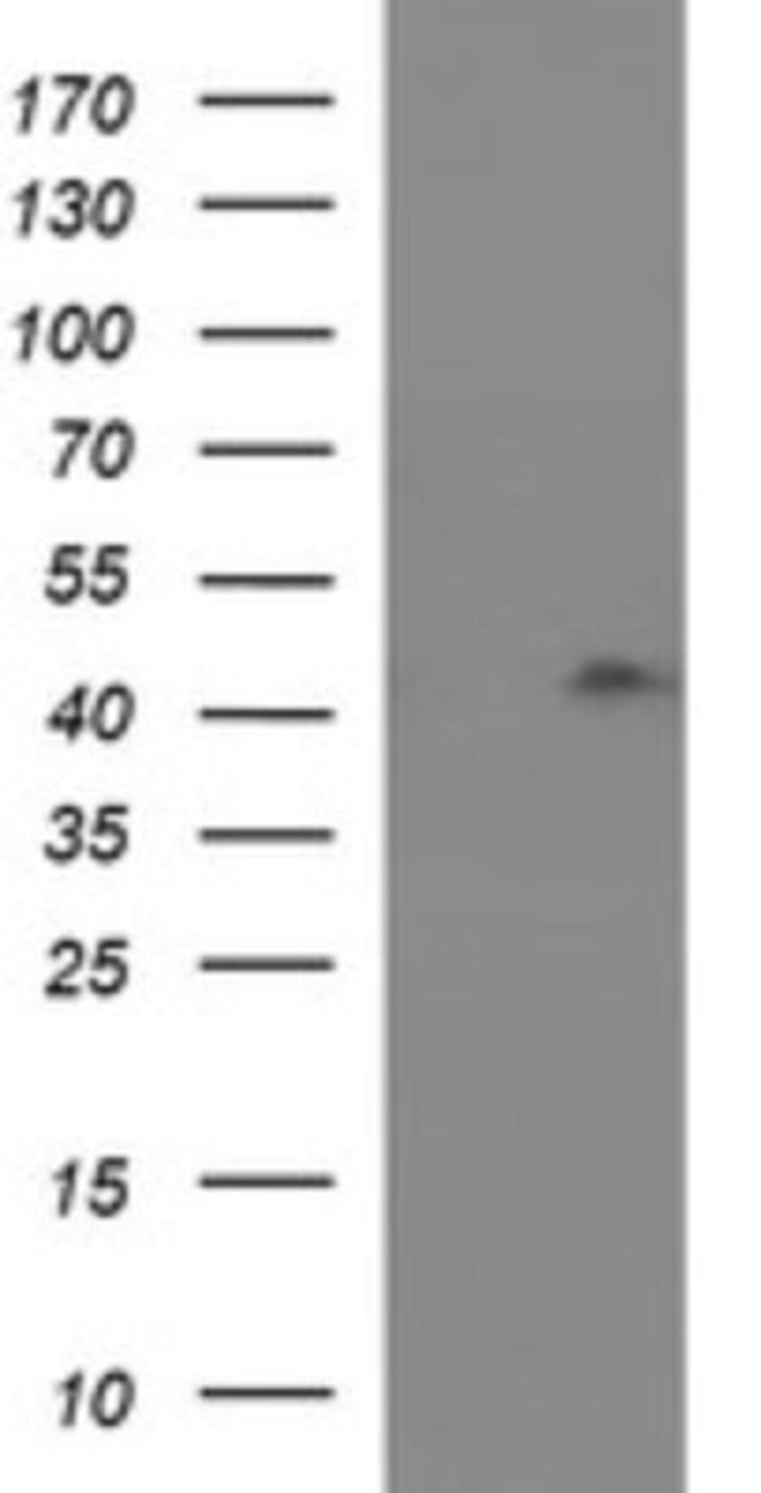 Western Blot: RASSF8 Antibody (1F5) [NBP2-45530] - Analysis of HEK293T cells were transfected with the pCMV6-ENTRY control (Left lane) or pCMV6-ENTRY RASSF8.