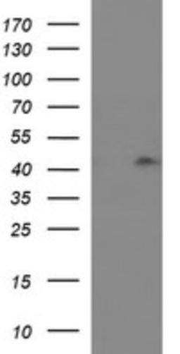 Western Blot: RASSF8 Antibody (1F5) [NBP2-45530] - Analysis of HEK293T cells were transfected with the pCMV6-ENTRY control (Left lane) or pCMV6-ENTRY RASSF8.