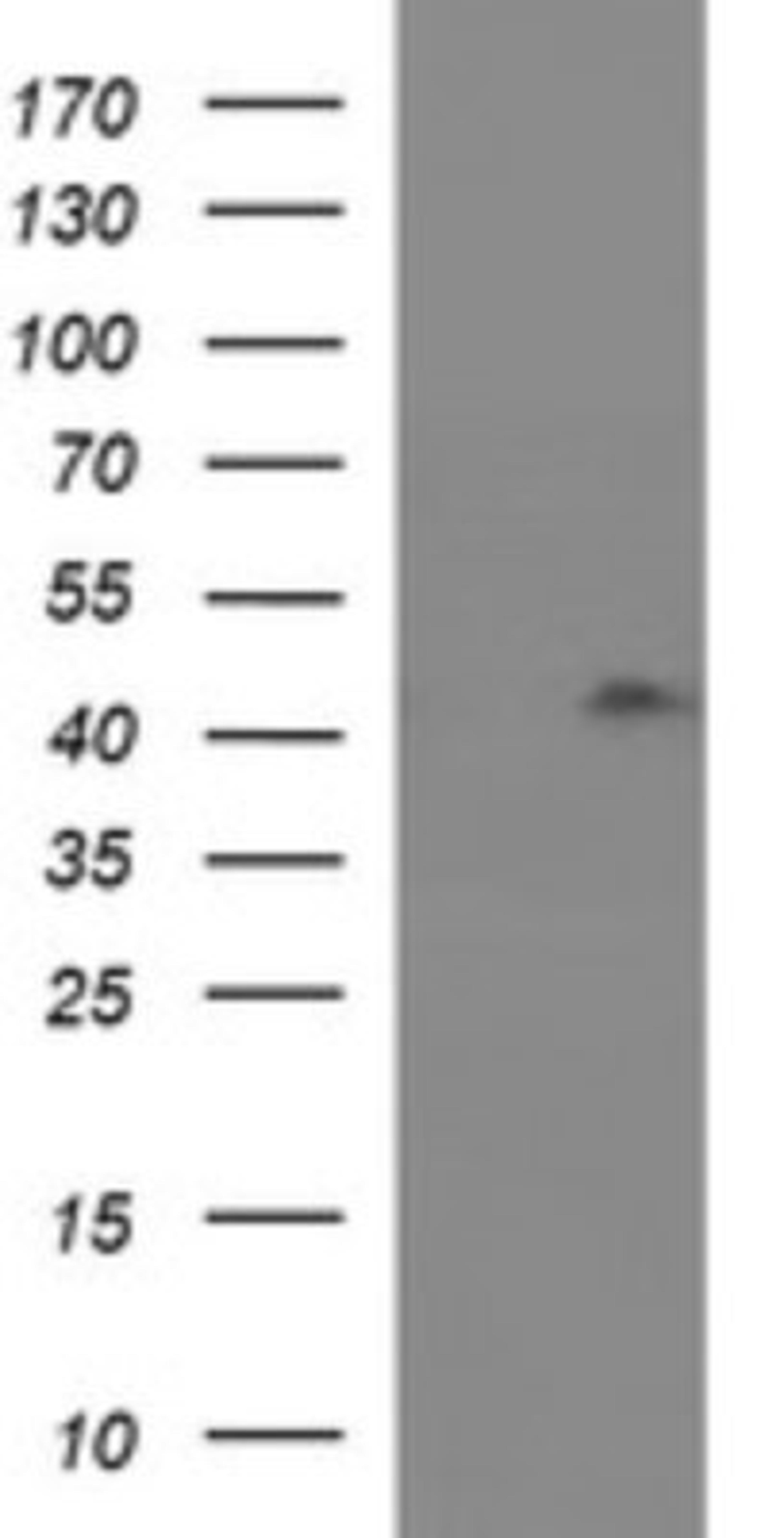 Western Blot: RASSF8 Antibody (1F5) [NBP2-45530] - Analysis of HEK293T cells were transfected with the pCMV6-ENTRY control (Left lane) or pCMV6-ENTRY RASSF8.