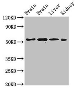 Western Blot. Positive WB detected in: Rat brain tissue, Mouse brain tissue, Mouse liver tissue, Mouse kidney tissue. All lanes: PPP2R2A antibody at 3ug/ml. Secondary. Goat polyclonal to rabbit IgG at 1/50000 dilution. Predicted band size: 52, 53 kDa. Observed band size: 52 kDa. 