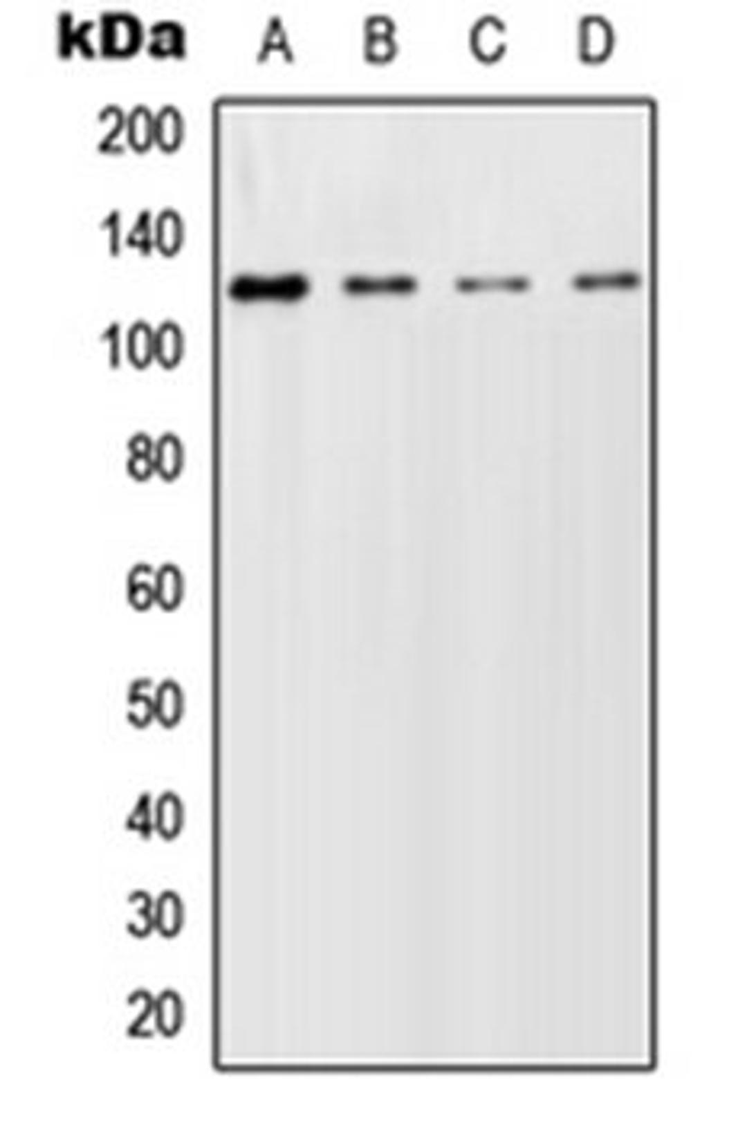 Western blot analysis of HeLa (Lane 1), SP2/0 (Lane 2), PC12 (Lane 3) whole cell lysates using GCFC2 antibody