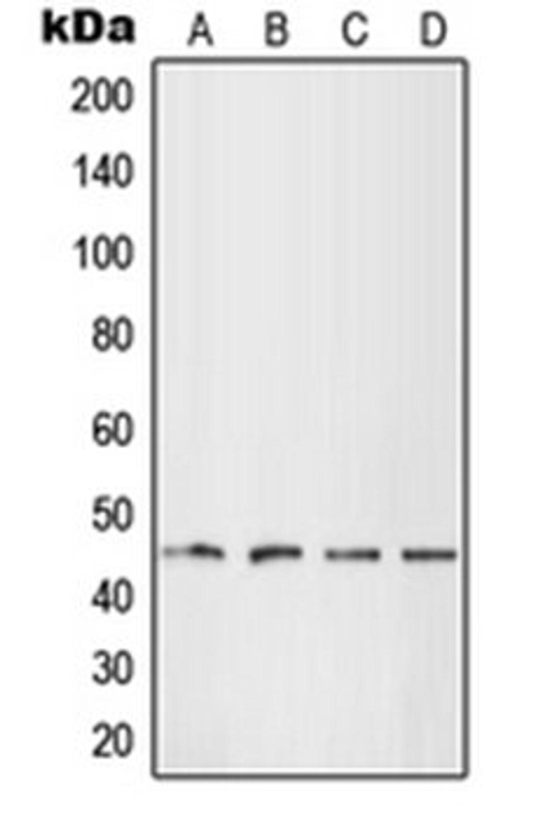 Western blot analysis of HEK293T (Lane 1), HepG2 (Lane 2), SP2/0 (Lane 3), H9C2 (Lane 4) whole cell lysates using LHX1 antibody