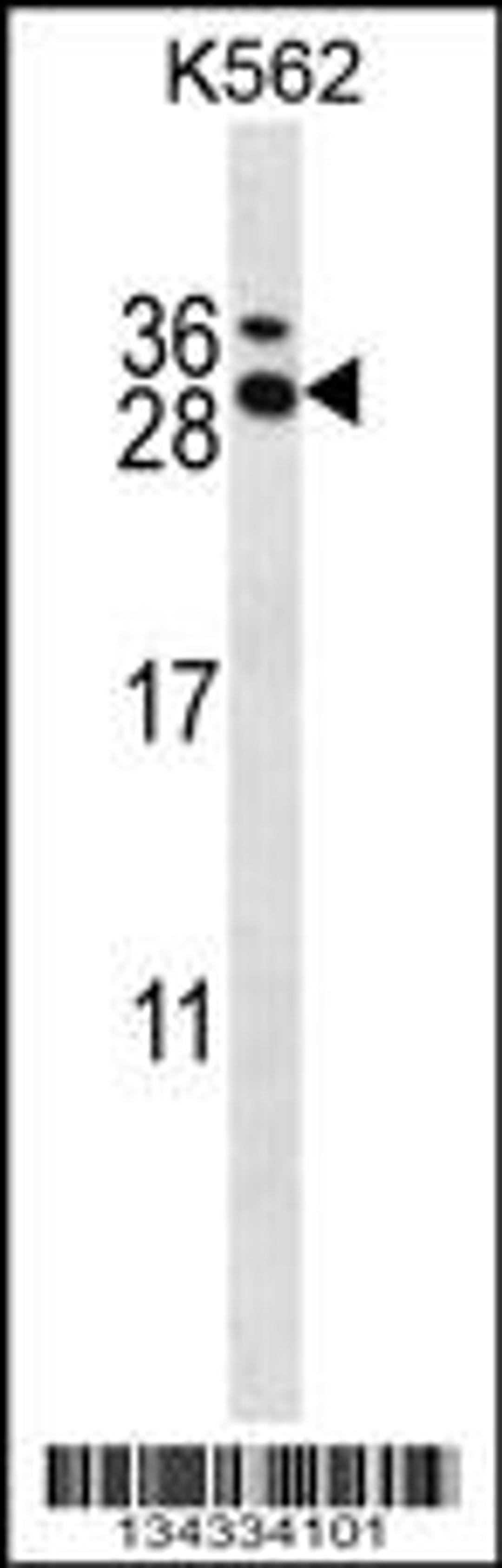 Western blot analysis in K562 cell line lysates (35ug/lane).