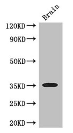 Western Blot. Positive WB detected in: Mouse brain tissue. All lanes: SFRP1 antibody at 3ug/ml. Secondary. Goat polyclonal to rabbit IgG at 1/50000 dilution. Predicted band size: 36 kDa. Observed band size: 36 kDa.