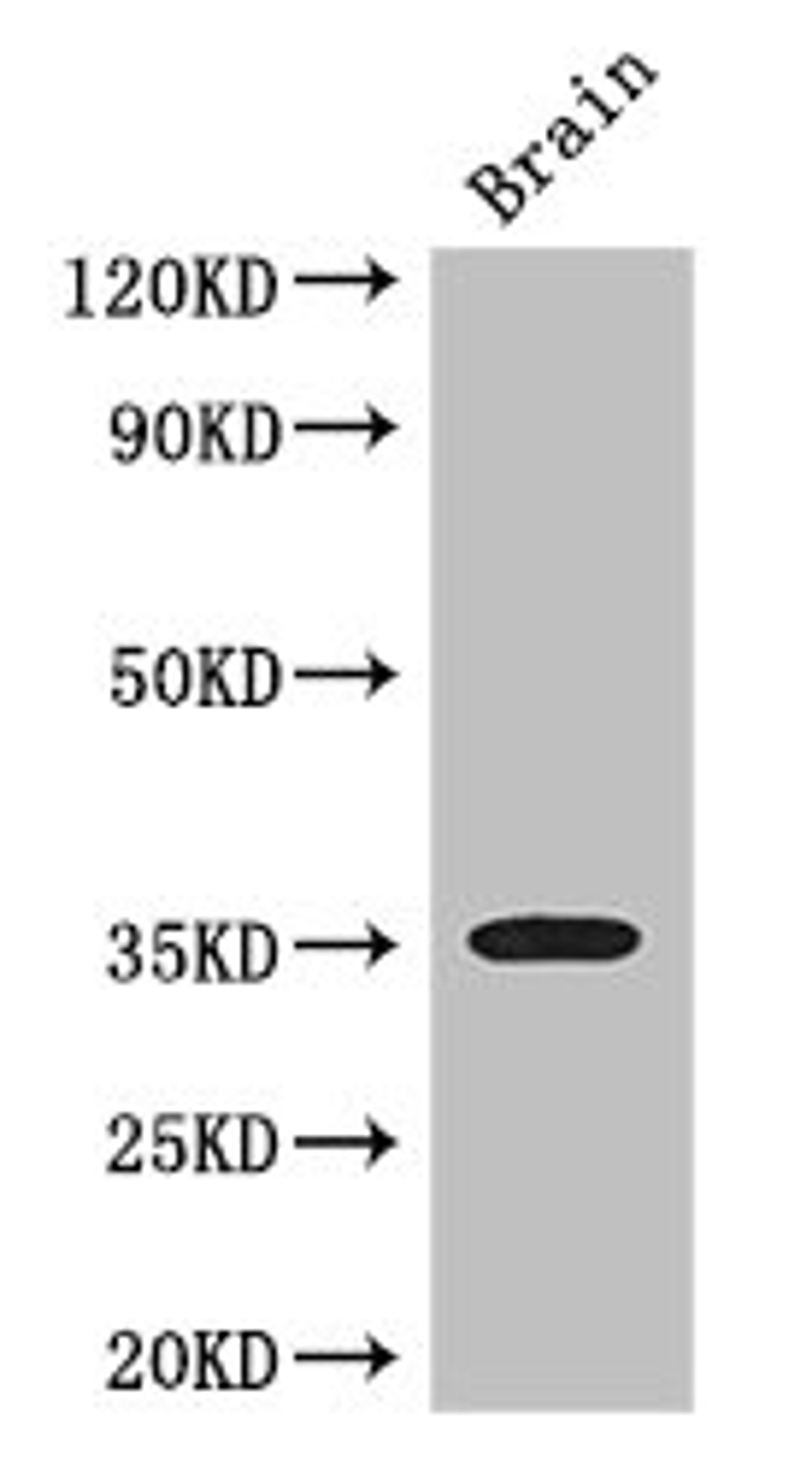 Western Blot. Positive WB detected in: Mouse brain tissue. All lanes: SFRP1 antibody at 3ug/ml. Secondary. Goat polyclonal to rabbit IgG at 1/50000 dilution. Predicted band size: 36 kDa. Observed band size: 36 kDa.