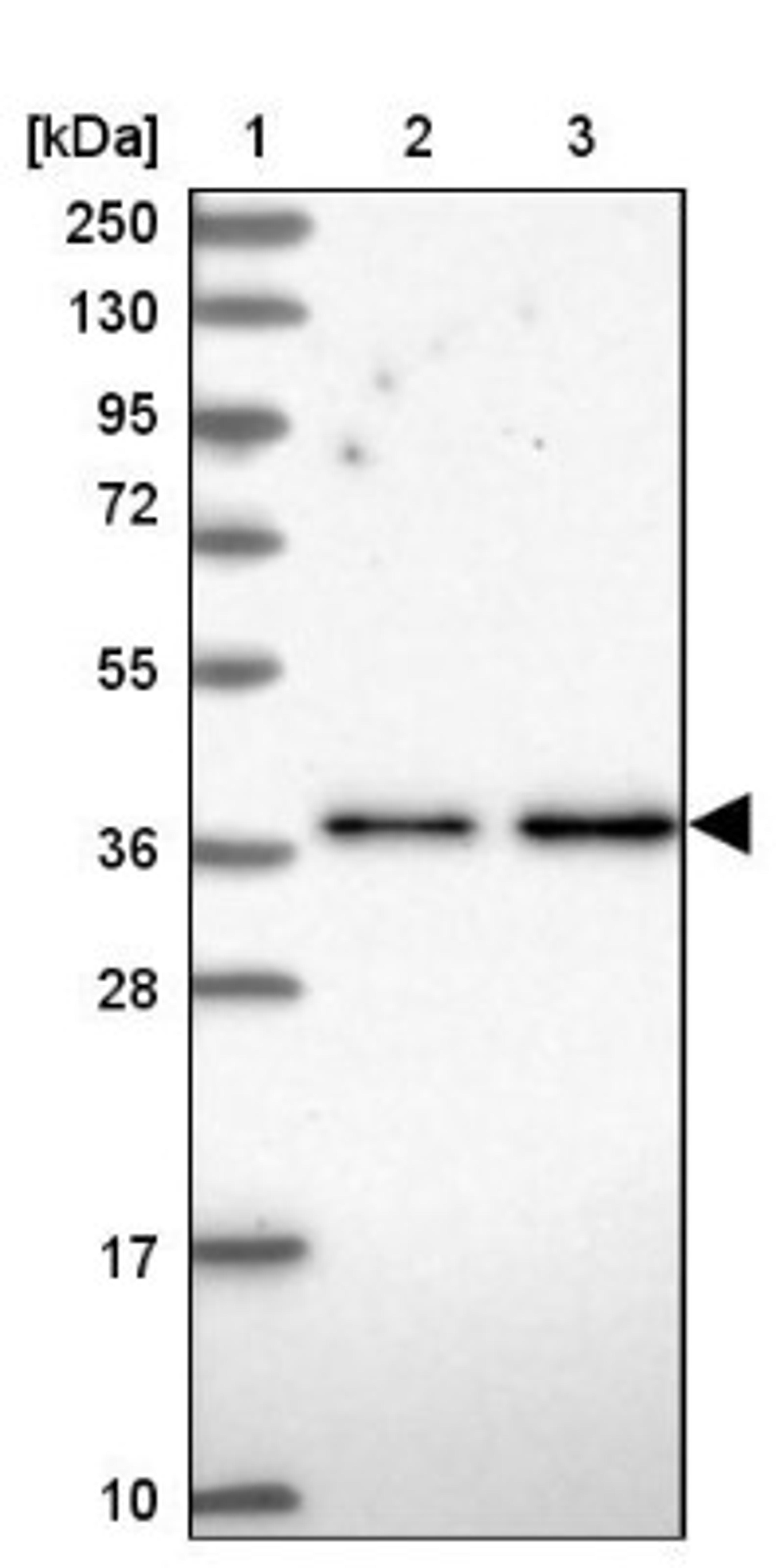 Immunohistochemistry: AP1M1 Antibody [NBP1-91674] - Lane 1: Marker [kDa] 250, 130, 95, 72, 55, 36, 28, 17, 10<br/>Lane 2: Human cell line RT-4<br/>Lane 3: Human cell line U-251MG sp