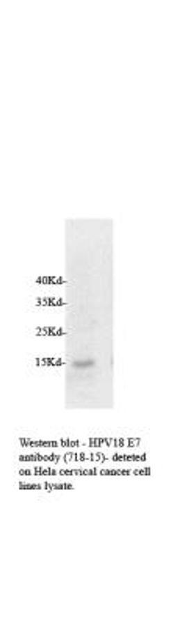 Western Blot: HPV18 E7 Antibody (718-15) [NB110-17215] - Papillomavirus 18 E7 in Hela whole cell lysate. Image from verified customer review.