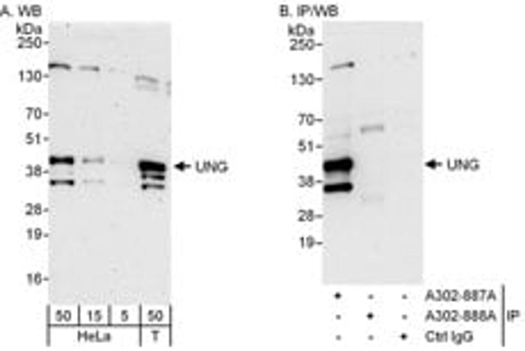 Detection of human UNG by western blot and immunoprecipitation.