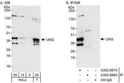 Detection of human UNG by western blot and immunoprecipitation.