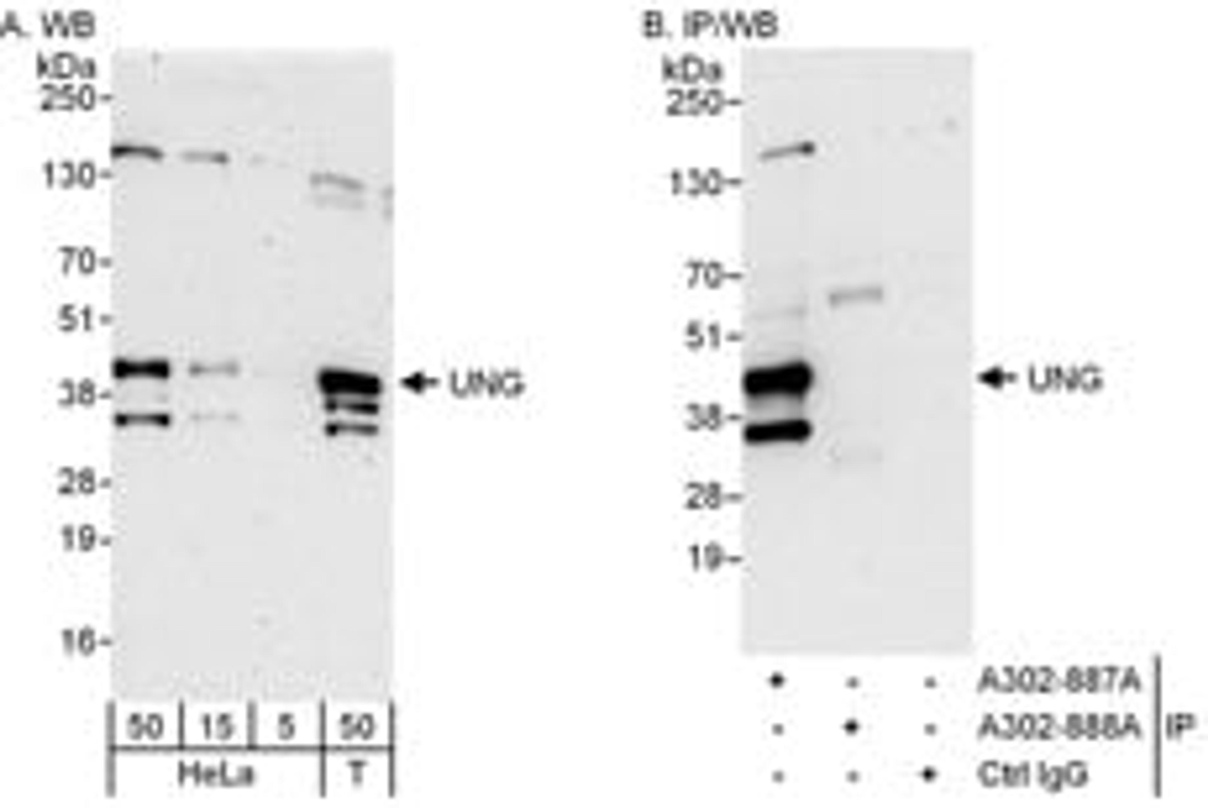 Detection of human UNG by western blot and immunoprecipitation.