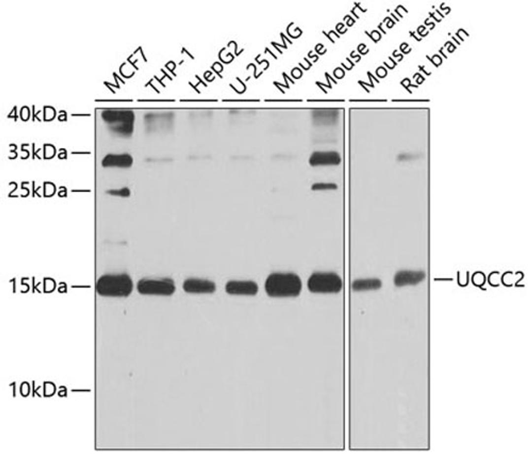 Western blot - UQCC2 antibody (A9986)