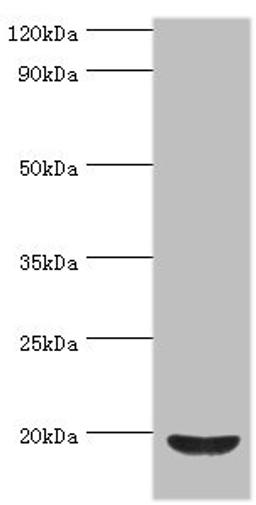 Western blot. All lanes: Low molecular weight phosphotyrosine protein phosphatase antibody at 4ug/ml + HepG2 whole cell lysate. Secondary. Goat polyclonal to rabbit IgG at 1/10000 dilution. Predicted band size: 19, 18, 15, 13 kDa. Observed band size: 19 kDa. 