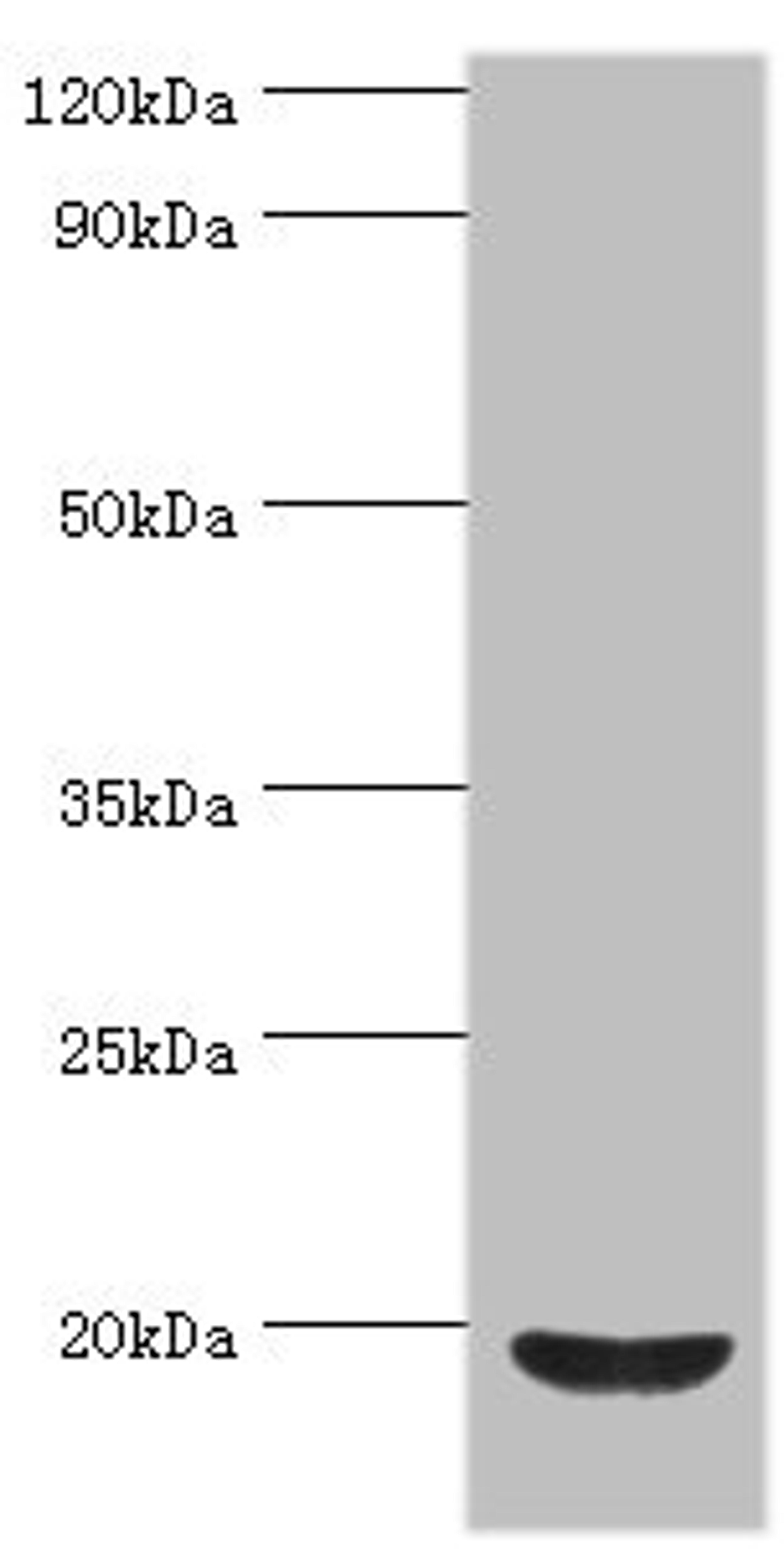 Western blot. All lanes: Low molecular weight phosphotyrosine protein phosphatase antibody at 4ug/ml + HepG2 whole cell lysate. Secondary. Goat polyclonal to rabbit IgG at 1/10000 dilution. Predicted band size: 19, 18, 15, 13 kDa. Observed band size: 19 kDa. 