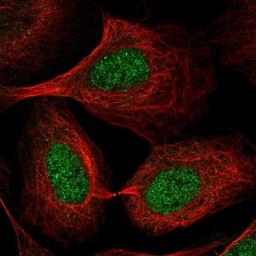 Immunocytochemistry/Immunofluorescence: p107 Antibody [NBP2-33735] - Immunofluorescent staining of human cell line U-2 OS shows positivity in nucleus.