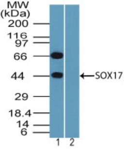 Western Blot: SOX17 Antibody [NBP2-24568] - analysis of SOX17 in mouse embryo brain lysate in the 1) absence and 2) presence of immunizing peptide using SOX17 antibody at 1 ug/ml. I goat anti-rabbit Ig HRP secondary antibody and PicoTect ECL substrate solution were used for this test.