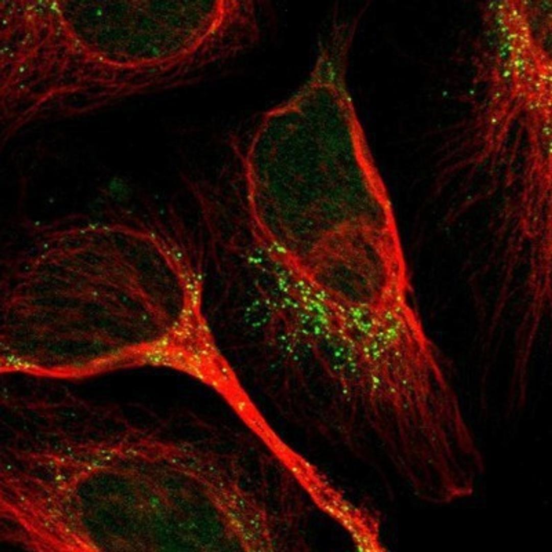 Immunocytochemistry/Immunofluorescence: GPRC5B Antibody [NBP1-87160] - Staining of human cell line U-2 OS shows positivity in vesicles.