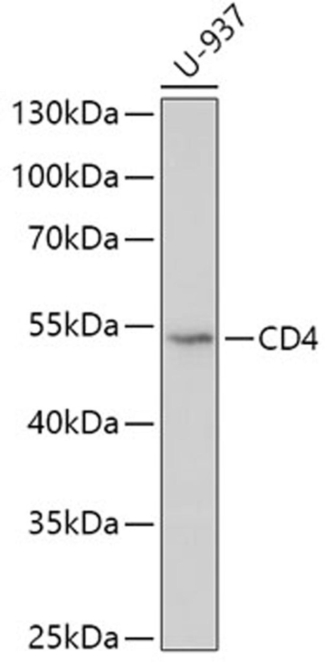 Western blot - CD4 antibody (A0362)